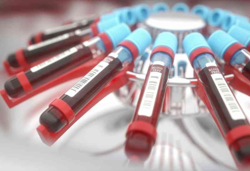 Prueba-de-Laboratorio-Anticuerpos-Totales-IgG-e-IgM-COVID-19