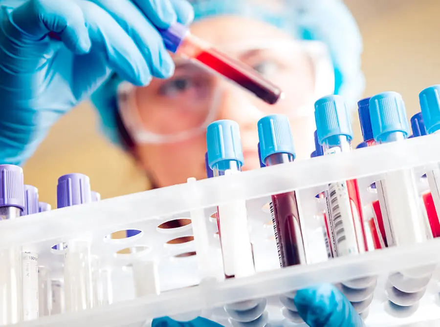 Prueba-Viral-para-Deteccion-de-COVID-19-por-PCR